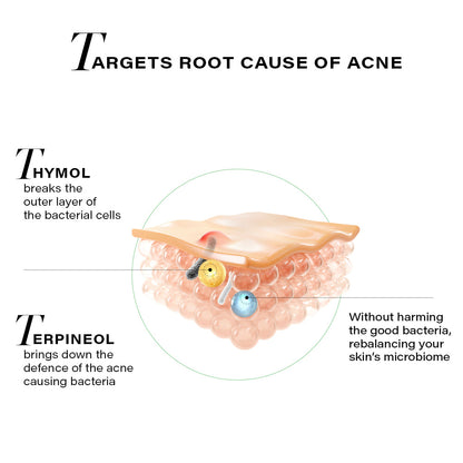 Novology Acne Spot Correction Kit with Cleanser and Gel