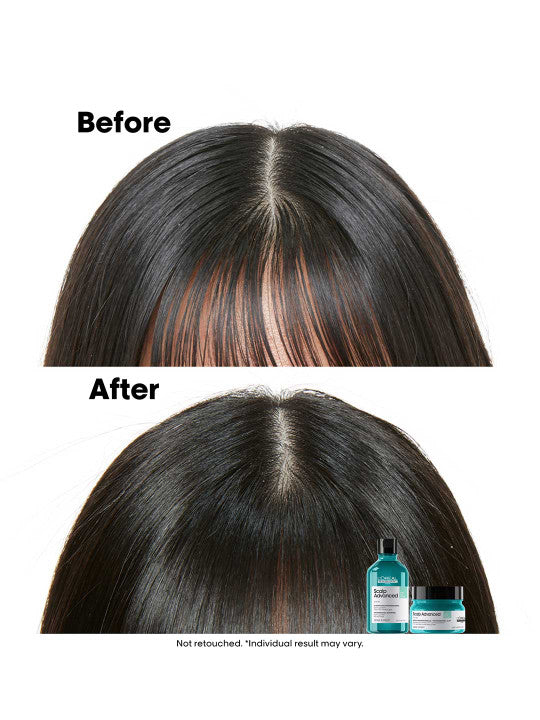 L'Oreal Professionnel Scalp Advanced Anti-Oiliness Shampoo for Greasy Oily Scalp