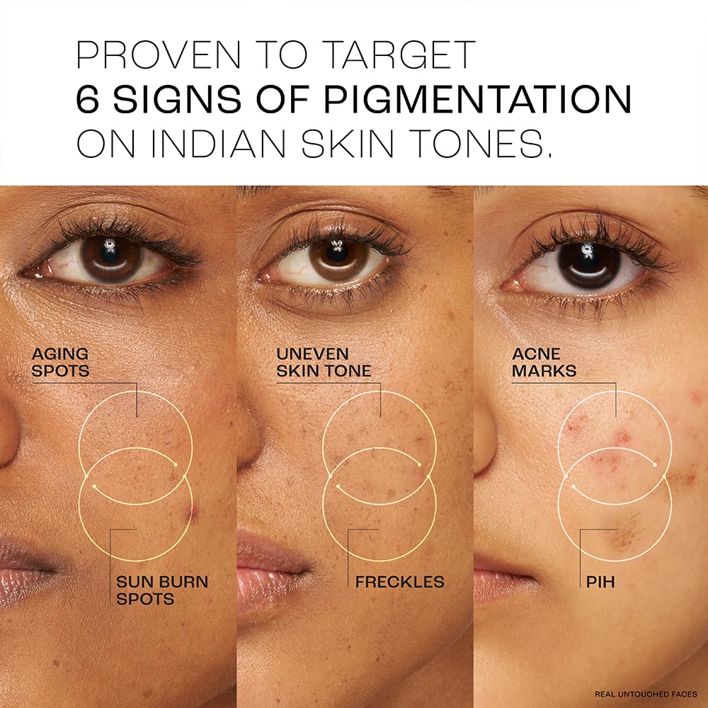 Lakme Perfect Radiance Day Gel Crème: Niacinamide & Resorcinol Pigmentation Treatment, 15g