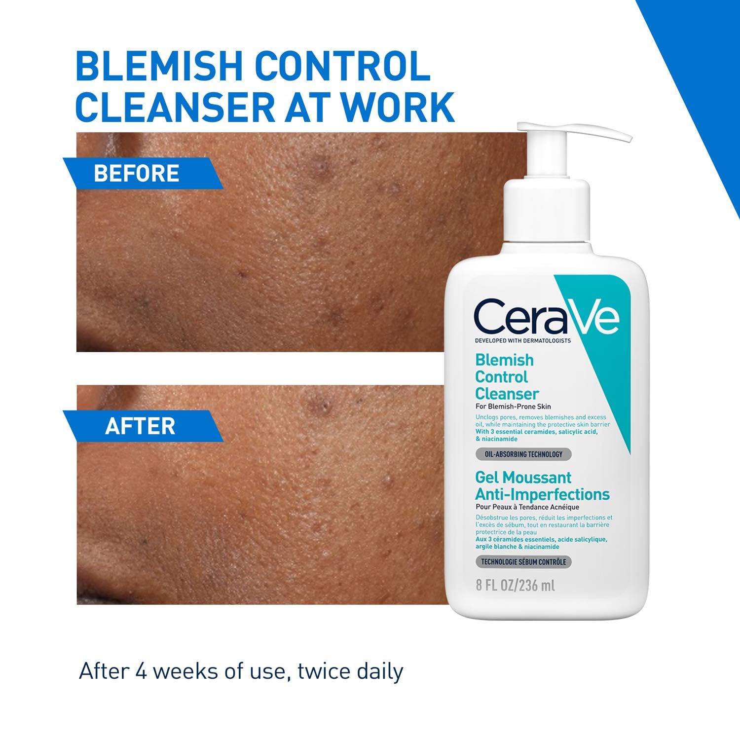 CeraVe Blemish Control Cleanser with 2% Salicylic Acid and Niacinamide