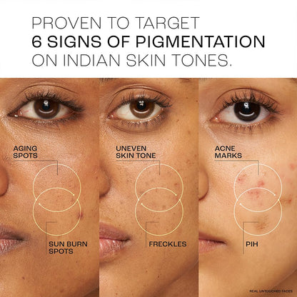 Lakmé Perfect Radiance Pigmentation Treatment Gel SPF 30 Niacinamide Resorcinol Antioxidants 50g