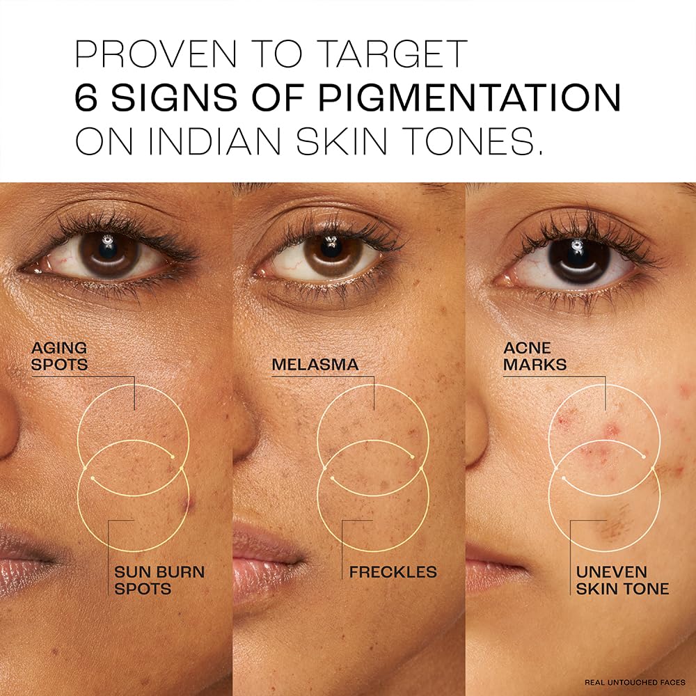 Lakme Perfect Radiance 15% Niacinamide Resorcinol Pro Retinol Pigmentation Treatment Serum