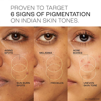 Lakme Perfect Radiance 15% Niacinamide Resorcinol Pro Retinol Pigmentation Treatment Serum