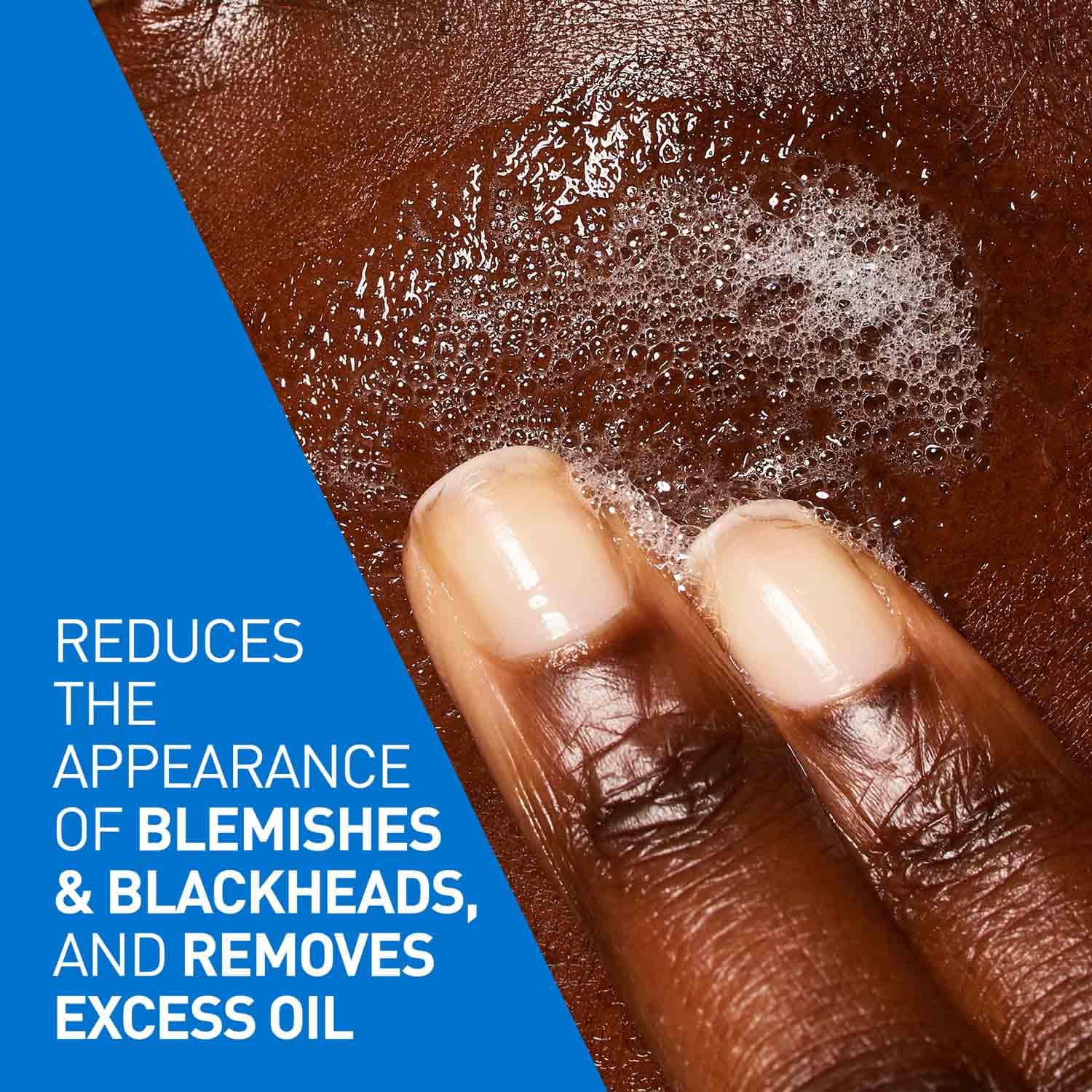 CeraVe Blemish Control Cleanser with 2% Salicylic Acid and Niacinamide