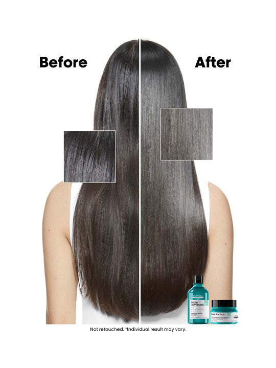 L'Oreal Professionnel Scalp Advanced Anti-Oiliness Shampoo for Greasy Oily Scalp