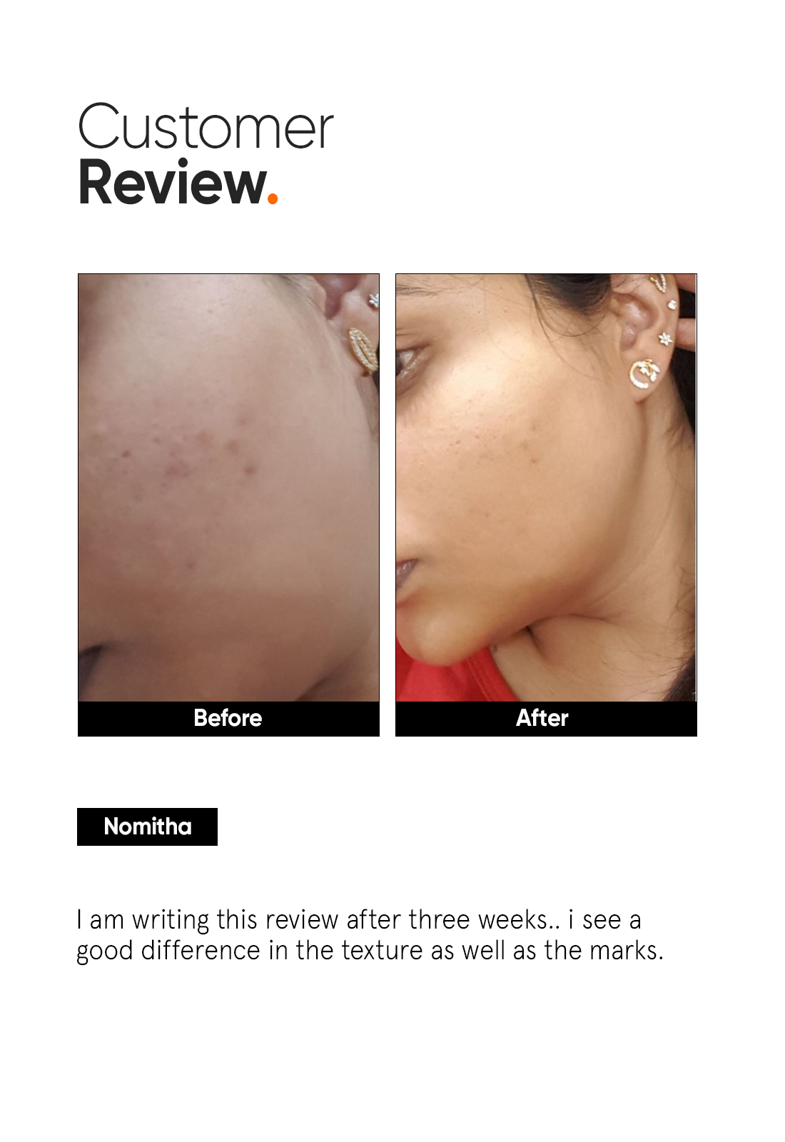 Minimalist 32% AHA PHA BHA Peeling Solution for Radiant Skin