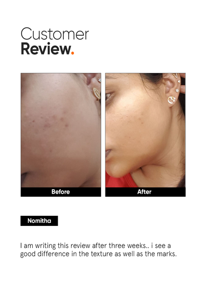 Minimalist 32% AHA PHA BHA Peeling Solution for Radiant Skin