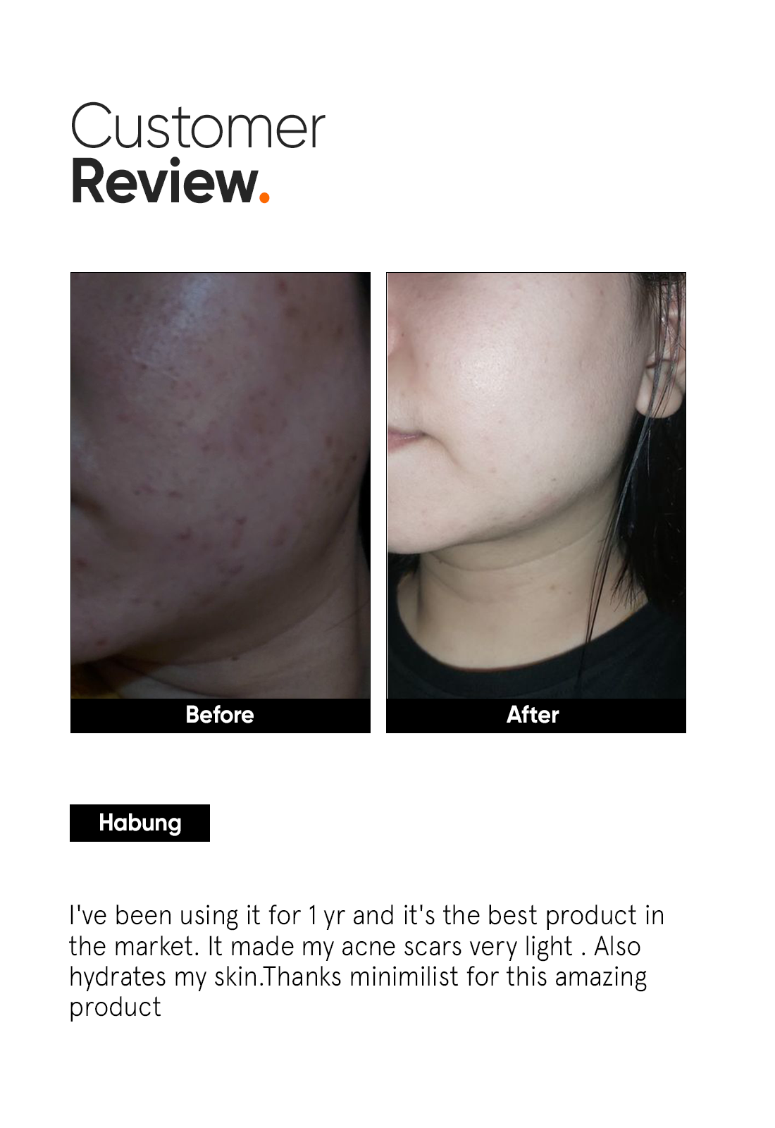 Minimalist Alpha Arbutin 2% Face Serum for Brightening Dark Spots