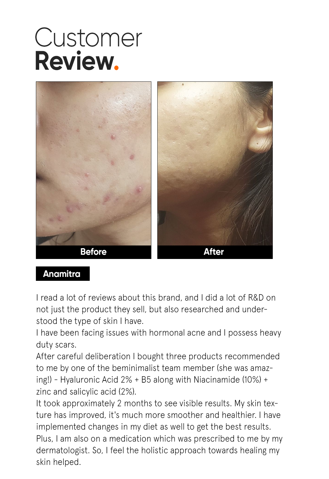 Minimalist Hyaluronic Acid and PGA 2 Percent Hydrating Face Serum