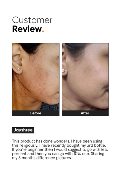 Minimalist Niacinamide 10% Face Serum for Oil Control and Pores