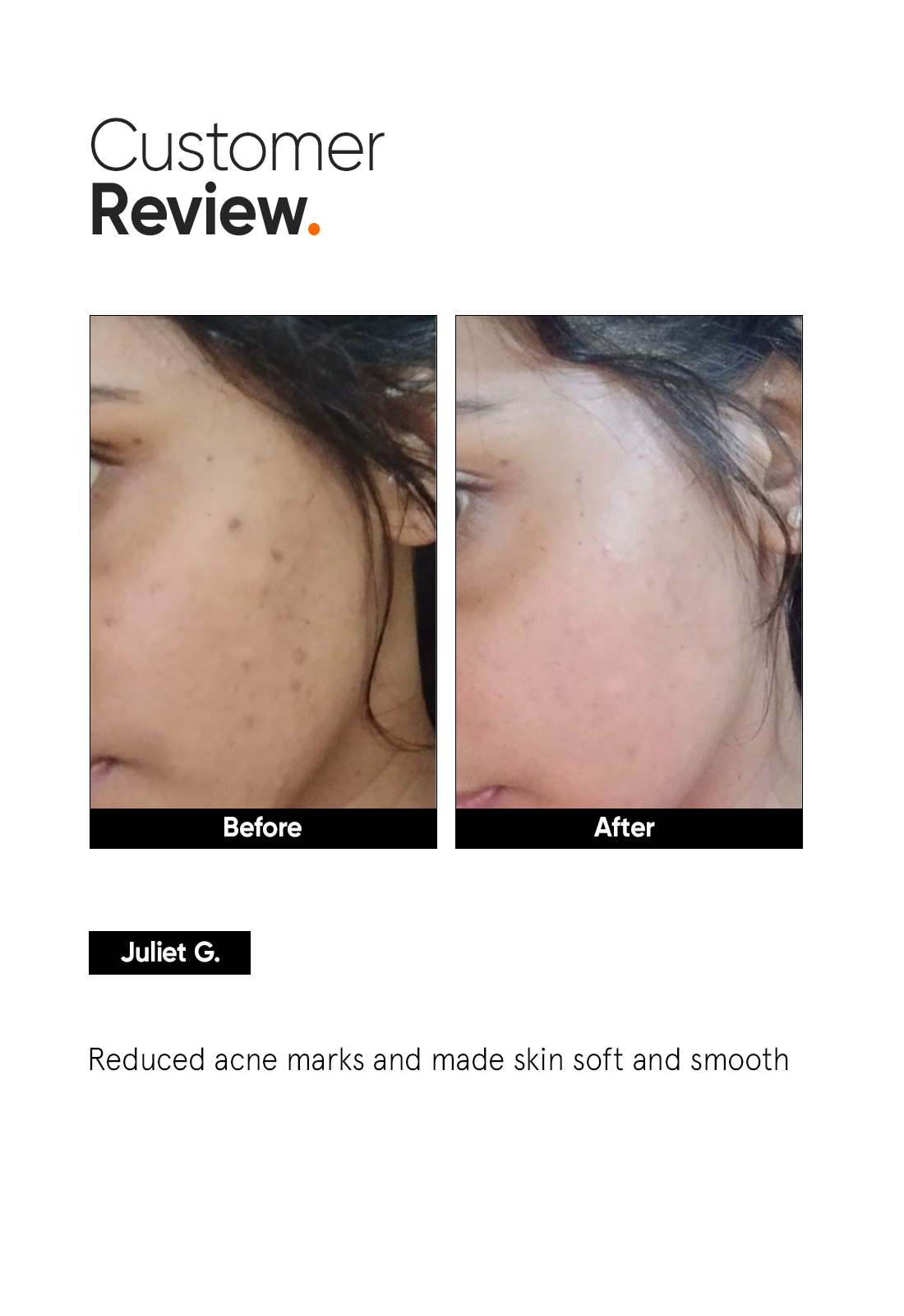 Minimalist 5% Niacinamide Serum with Hyaluronic Acid for Sensitive Skin