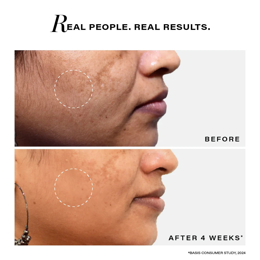 Novology Bi-Phasic Hyperpigmentation Face Serum for Dark Spots and Glow