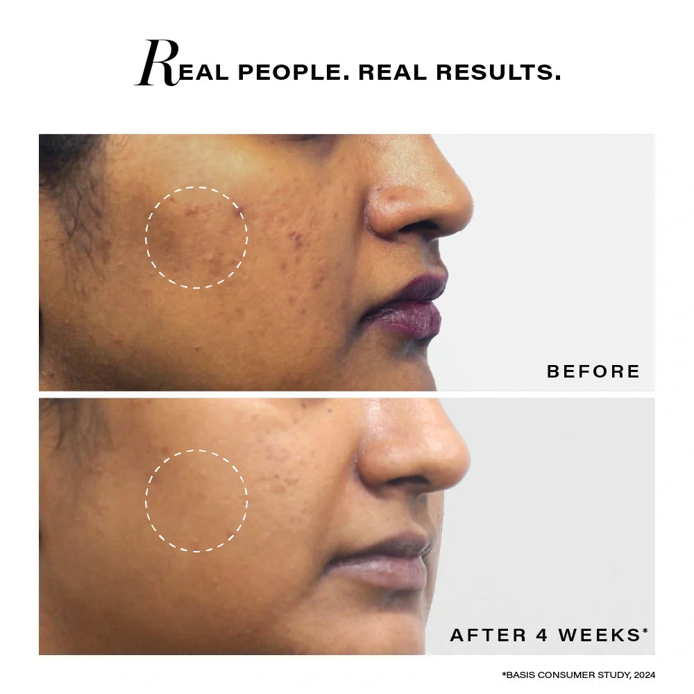 Novology Pigmentation Reduction Moisturizer SPF 30 Sunscreen With Niacinamide