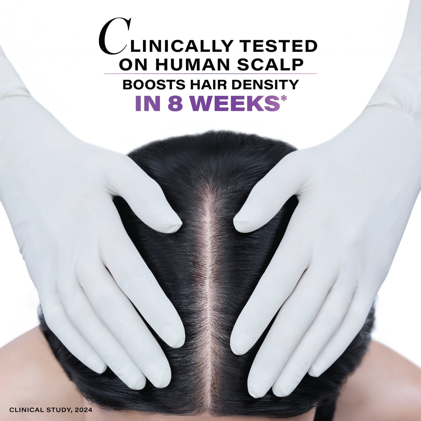 Novology Follicle Revive Hair Growth Serum with 4% Dynagen