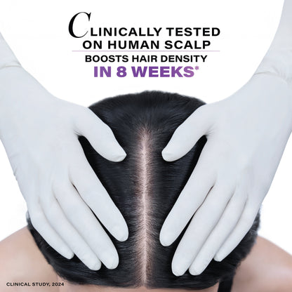 Novology Follicle Revive Hair Growth Serum with 4% Dynagen