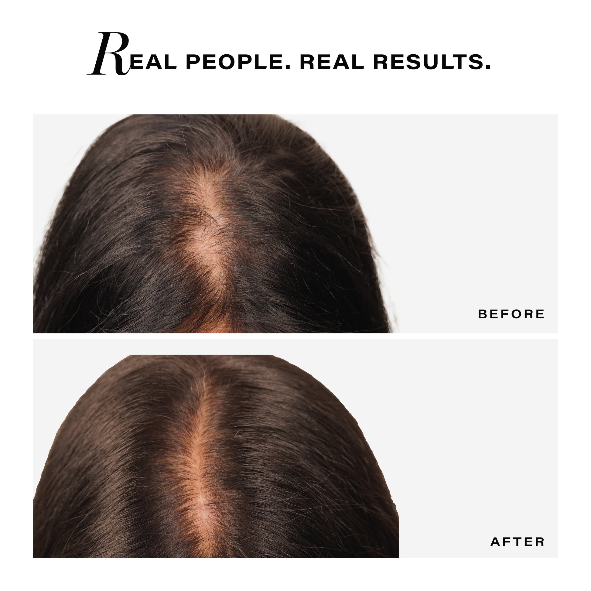 Novology Follicle Revive Hair Growth Serum with 4% Dynagen