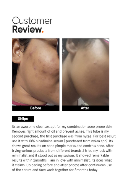 Minimalist Salicylic Acid LHA 2% Oil Control Acne Face Cleanser