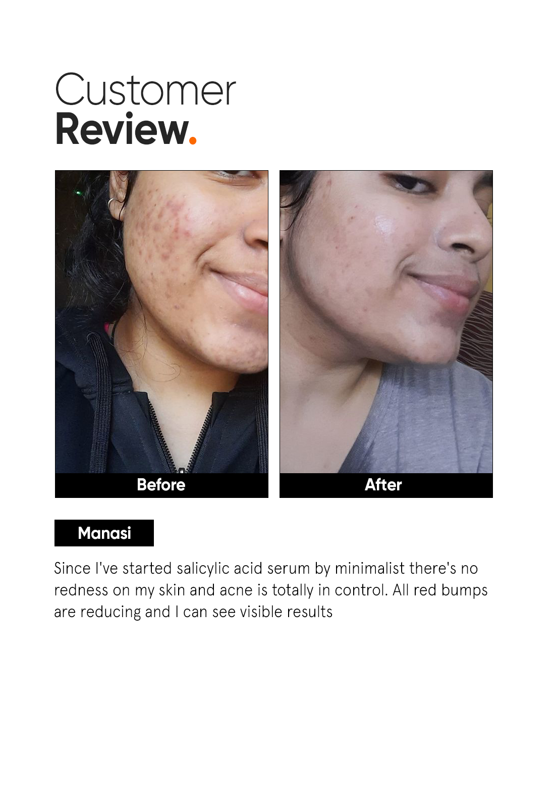 Minimalist Salicylic Acid 2% Face Serum for Acne and Blackheads