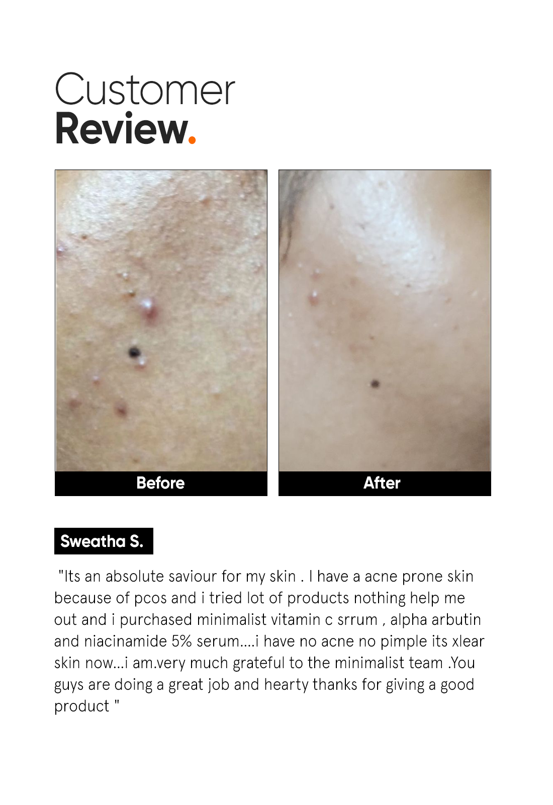 Minimalist Vitamin C 10% Face Serum for Brighter Glowing Skin