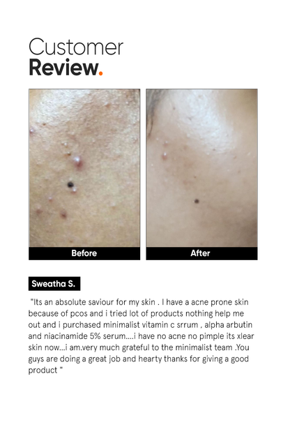 Minimalist Vitamin C 10% Face Serum for Brighter Glowing Skin