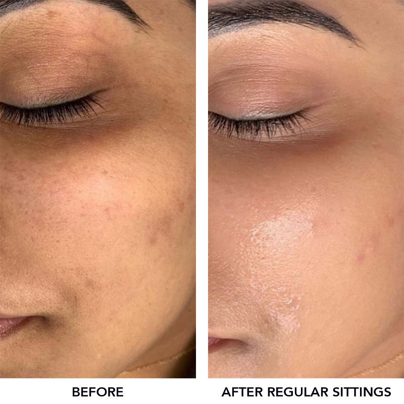 https://images-static.nykaa.com/media/catalog/product/d/d/dd2e2088906060214183_05x.jpg